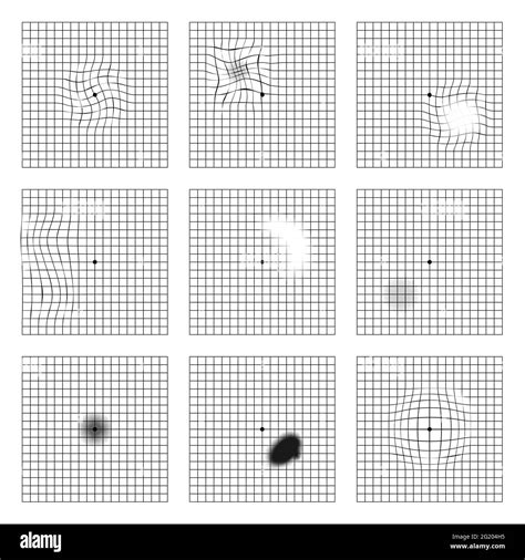 amsler grid results